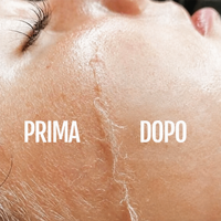 NUN™ SetaGlow – Dermaplaner Sonico per il Viso